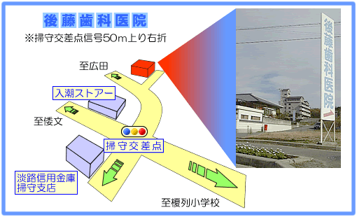 �A�N�Z�X�}�b�v